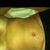 Swelling under my breasts never changes. It always looks like that.