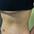 Very unhappy with my shape. I do not mind the scars. I should have just kept the old ones. Now I am more self conscience.