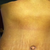 Above my belly button is starnge. I call it "The confused zone"
Under my breasts sticks out.  You can see it through my clothes. He did not do lipo, which I think would have given me a shape.