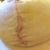 3 weeks PO - incision seems to be spreading and draining.