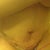 Not my favorite pic,  you can see the swelling and my belly button looks terrible, but I am pretty sure it will shape up once the swelling goes down.