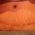 Week 5 scar 2 1/2 weeks w oleevA silicone strip