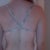 3 weeks post op, can't believe this is all that's holding up my girls!