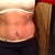 6 weeks right side need insicion correction and pulled tighter, my thought, still swollen , but I'm happy