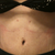 11 days post op.  New belly button.  Tummy is flat with very little visible stretch marks.