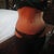 2011 - 5 months post op