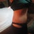 2011 - 5 months post op