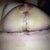 Right side. Pretty swollen and still pretty bruised. I was actually surprised to see how bruised it was tonight when looking at the pictures.