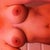 3months post-op... Don't know why site turned it :/