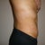 4 weeks post-op