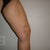 4 weeks post-op