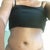 7 weeks post op