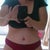 Two weeks post op.  Now THATS BETTER!