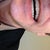 You can see how the canine didn't track with the aligner. Attachment failed. Sadly.