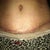 9 weeks scar