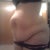 Looking square shape), hernia and scar issue on top
