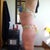 2 months P/O Left side