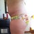 2 months P/O left side scar