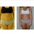 2009 Before on left, after on right
