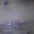 19 days po. I love how my scar is healing