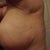 see the knots & dent in my back /underarm areas :/
