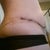 Loving the scar!