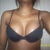 Breasts at 3 1/2 weeks post op