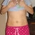 2 days post-op