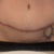 This was my scar and previous tattoo that i had covered.