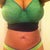 15 days post op