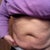 PreOp 1/10/12