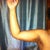 Post op arms - 3 weeks