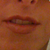 before lips