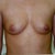 1999 Before