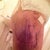 So colourful......................leg bruised from lipo 4 days after surgery