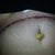 1 day PO I love it but I'm already swollen lol