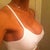 R Side w/ Sport bra @day 10