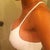 L Side W/ sport bra @day 10