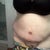 7 days post op