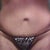1st Tummy Tuck performed...my right side has over hanging skin and my scar is alot higher up