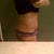 Tummy Tuck 3 weeks post-op ....i never wear granny panties but they were alittlemore comfortable at this point