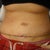 Day 6. Why does my belly button look like a little vagina?  I hope its going to be ok :(