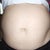 My big belly 3 1/2 weeks prior to surgery