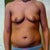 tummy w/ Underwear On - breast pic too