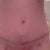3 week PO. Can start to tell my shape a little better!