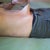 before- extra skin