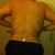 After- 3 days post