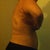 After- 3 days post