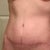 seven weeks PO - one more week before I can work my abs!