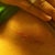 Day 12 left scar. It's a little pink, but beautiful. The black/brown is the remaining skin glue that hasn't come off. :)
